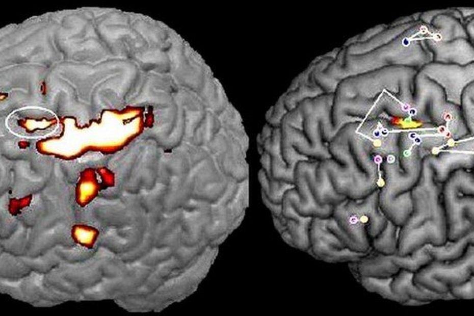 Des Chercheurs De Toulouse Identifient Une Zone De L Criture Dans Le