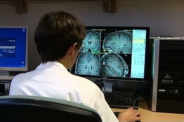 La neurologue examine le cerveau du patient avant l'intervention