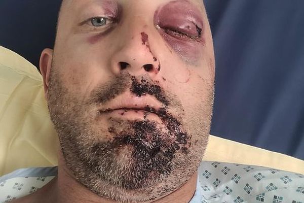 Christophe Coutou a été violemment agressé le 5 juillet à Rodez.