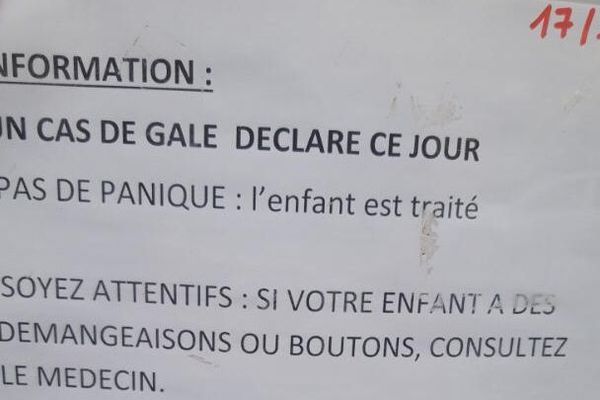 Villeneuve-lès-Maguelone - Nouveau cas de gale signalé à l'école Françoise Dolto - 17.10.19