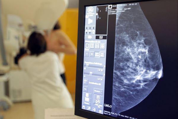 Un mammographe arrive à l'hôpital de Gray en Haute-Saône