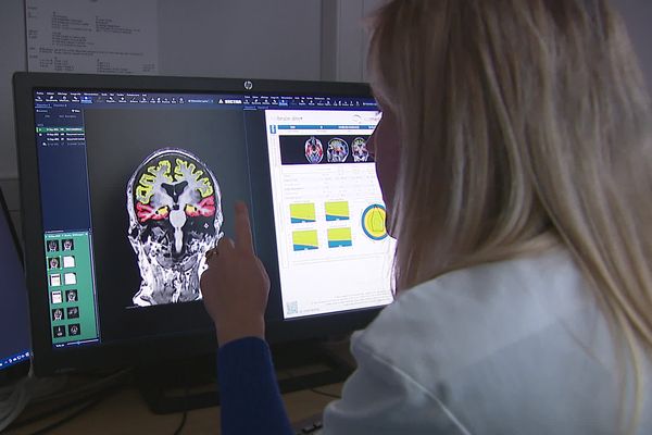 Plus vite la maladie d'Alzheimer est diagnostiquée mieux le traitement d'un patient est adapté. En l'absence de médicament, seule une prise en charge précoce peut freiner l'évolution de la maladie.