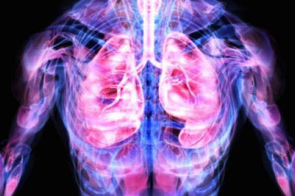 La maladie génétique entraîne des difficultés respiratoires. Elle est de plus en plus fréquente en France. 