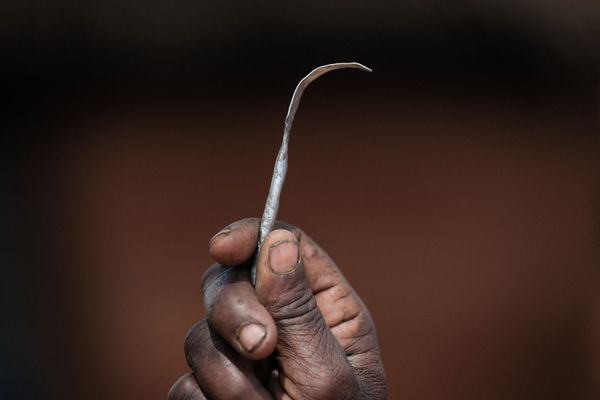 On estime que 125 000 femmes victimes d'excision vivent sur le territoire français.