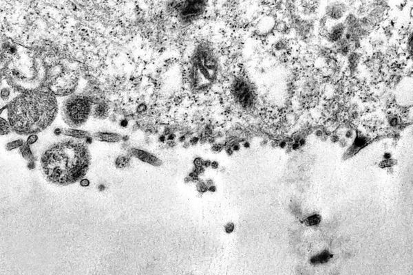 Une observation d'une cellule en train d'être infectée par le coronavirus SARS-CoV-2, responsable du covid-19.