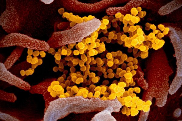  Cette image de microscope électronique à balayage montre le SARS-CoV-2 (jaune), également connu sous le nom de 2019-nCoV