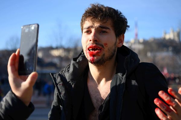 Le jeune homme explique avoir eu 9 dents cassées après avoir subi des brutalités policières, lors de la manifestation de mardi 10 décembre.