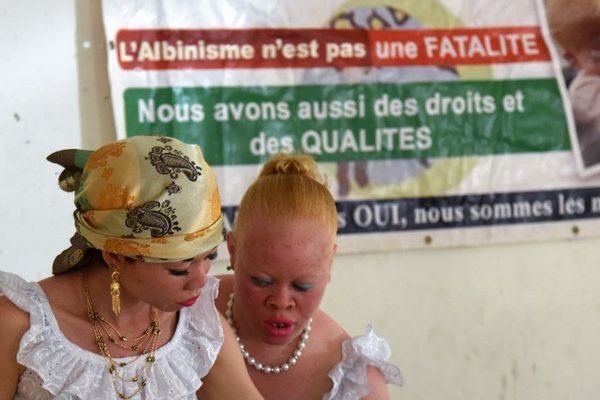 Deux femmes albinos tiennent un stand à Abidjan, en Côte d'Ivoire. 