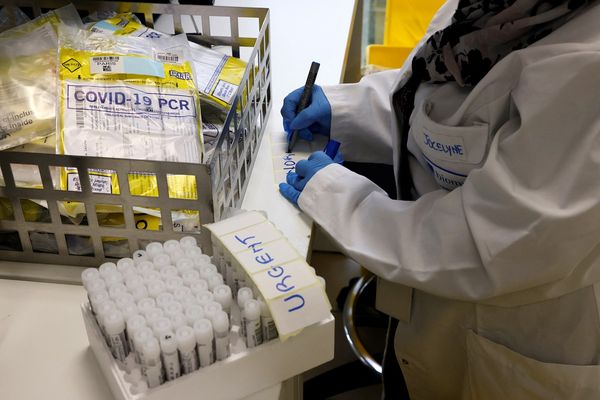 L'épidémie de COVID 9 est en pleine expansion depuis le début du mois de juin en Auvergne.