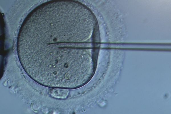 Fécondation in vitro au CHU de Limoges