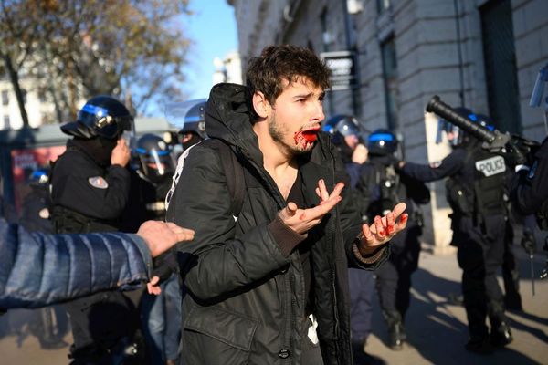 Le jeune Arthur N., 23 ans, dit être victime d'une "agression gratuite" à Lyon pendant la manifestation pour les retraites le 10 décembre 2019. Photos et vidéos prises par des témoins de la scène ont permis de mettre en cause deux policiers.