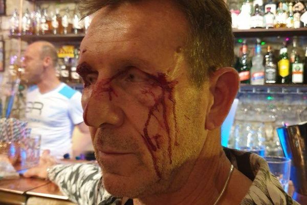 Dans la nuit de vendredi à samedi, une bagarre a éclaté au moment de la fermeture. Le gérant du bar le Pride à Nîmes  (photo) et son employé ont été tabassés par deux individus. Les victimes sont sous le choc, d'autant plus que le caractère homophobe de l'agression n'a pas été retenu par le parquet.