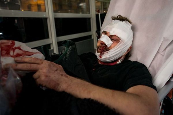 Soigné dans la rue, Ameer al Halbi a ensuite été conduit à l'hôpital, suivi par la consoeur-photographe qui était à ses côtés quand les policiers ont chargé dans une petite rue près de la Bastille, ce 28 novembre à Paris.