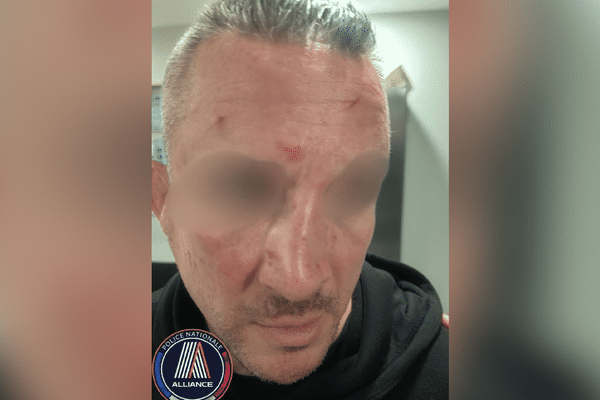 Le policier a été agressé en marge du match Auxerre-Rennes