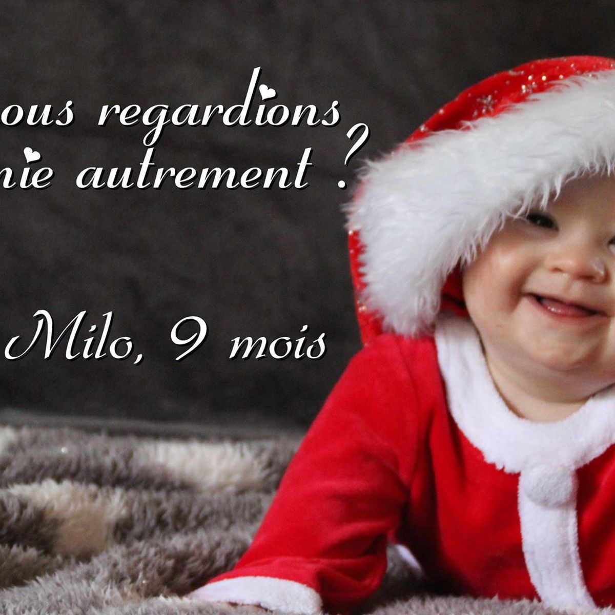 Un Bebe Jurassien Porteur De Trisomie 21 Remporte Un Concours Photo