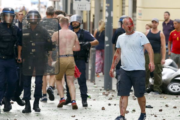 Les heurts entre supporters anglais et russes ont fait 35 blessés dont quatre dans un état grave.