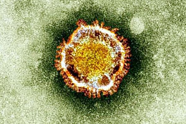 Une souche de Coronavirus.