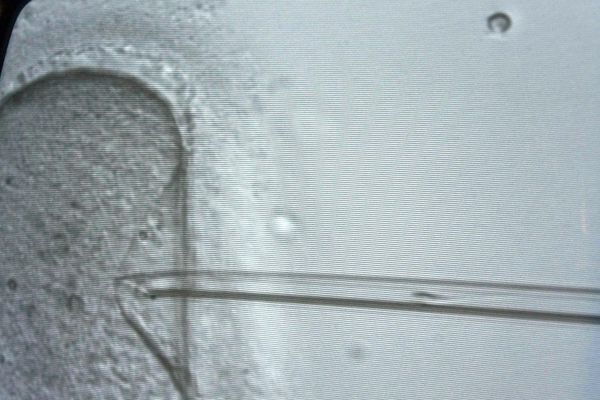 Implantation d'un spermatozoïde sur un embryon