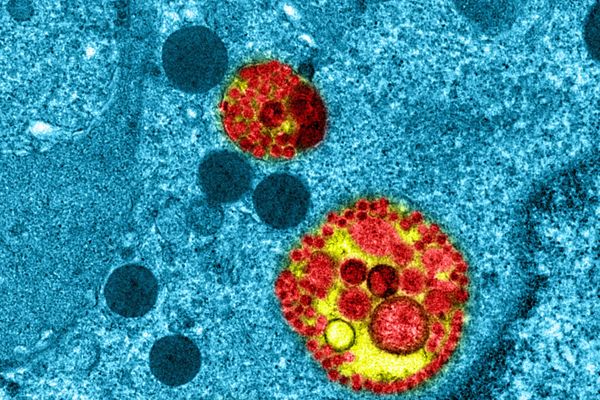 Observation intracellulaire d’épithélium respiratoire humain reconstitué MucilAir™ infecté par le SARS-CoV-2. Cette image a été obtenue par microscopie électronique à transmission sur la plateforme d’imagerie de l’Université Claude Bernard Lyon 1 (CIQLE).