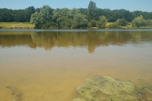 Comme l'été dernier, il est interdit de se baigner dans le Lac de la Forêt à Châtellerault.