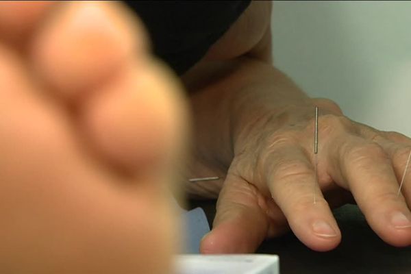 L'acupuncture une médecine millénaire