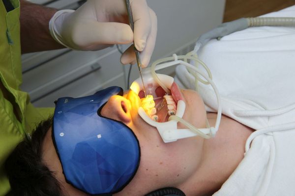 Orthodontiste posant de bagues sur les dents d'un adolescent : image d'illustration