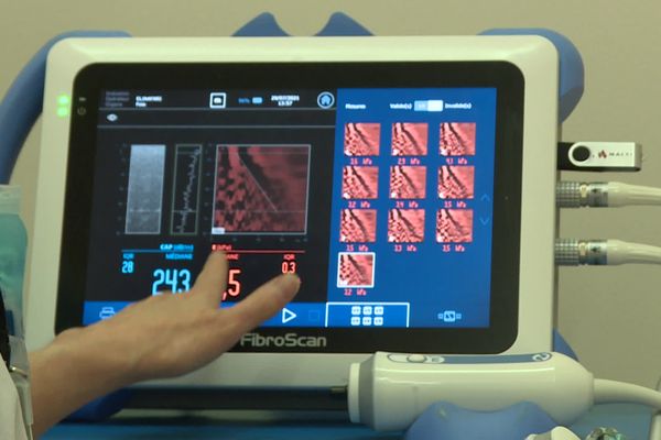 FibroScan pour dépister la NASH