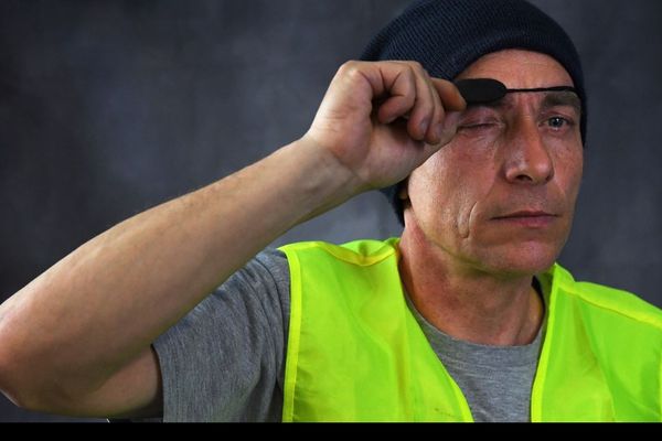 Patrice Philippe, chauffeur routier, a perdu un oeil dans une manifestation le 1er décembre