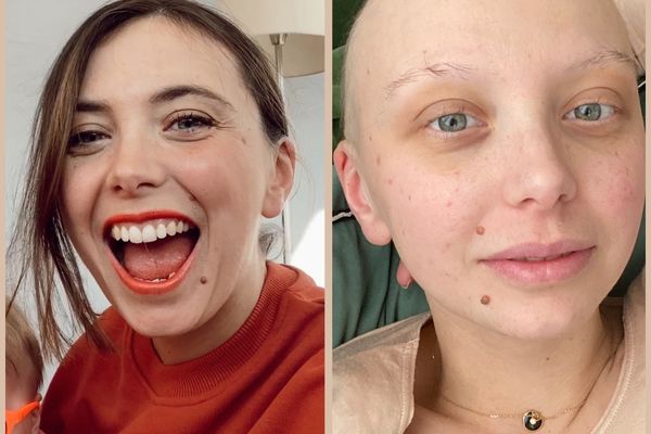 Emilie Daudin a vaincu un cancer du sein triple négatif. Très engagée, elle mène aujourd'hui de nombreux projets.