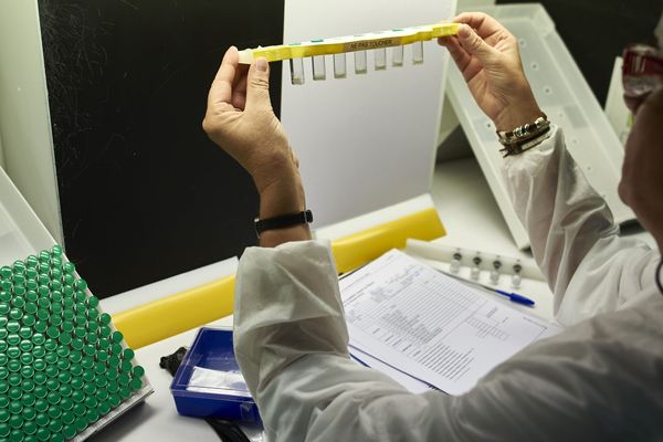 Dans un laboratoire de recherche à Marcy-l'Etoile, le 7 juillet 2016.