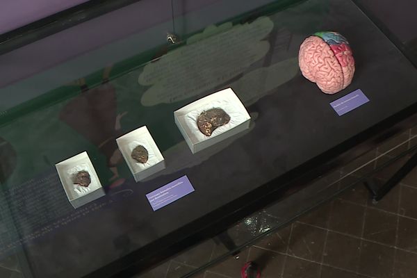 Le musée Bargoin présente des pièces de cerveaux de sa collection archéologique, datant du Ier et IIe siècle, dans le cadre d'une exposition.