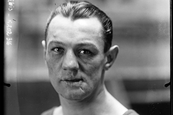 Eugène Criqui, une "gueule cassée" de la Première Guerre mondiale. Surnommé "le boxeur à la mâchoire de fer", il est devenu champion du monde de boxe anglaise en 1923.