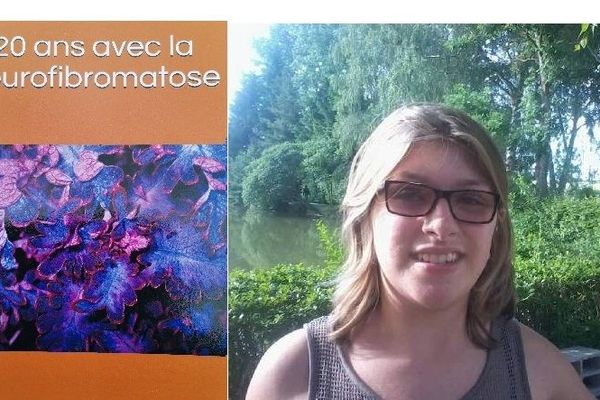 Chloé Wagner espère que son livre favorisera une meilleure connaissance de la neurofibromatose, et l'accélération des recherches de traitement