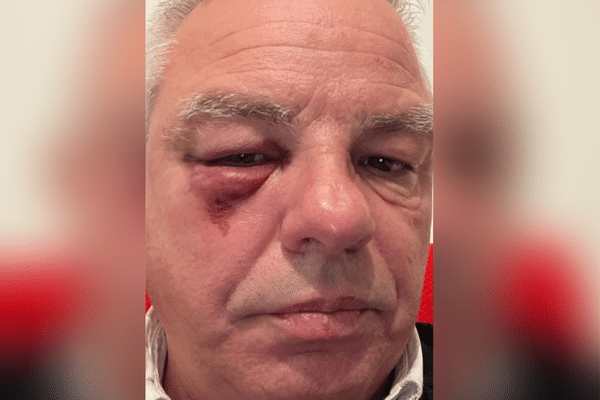 Le maire de Péage-de-Roussillon (Isère), André Mondange, a été victime d'une agression dans la nuit du jeudi 21 au vendredi 22 décembre à Avignon (Vaucluse).