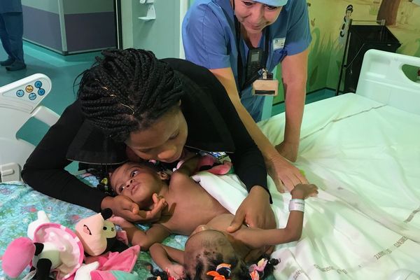 Bissie et Eyenga, les deux petites soeurs siamoises prêtent pour le bloc opératoire à l'hôpital Femme Mère Enfant (HFME) de Bron, mercredi 13 novembre 2019