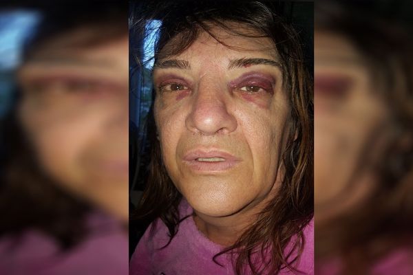 Nathalie affirme avoir été agressée en raison de sa transidentité, dans le quartier des Vergnes à Clermont-Ferrand.