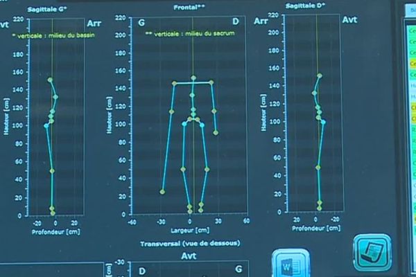 Bilan postural obtenu grâce à Sam 3D