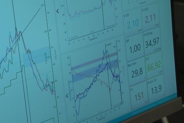 Ecran de contrôle d'un matériel médical