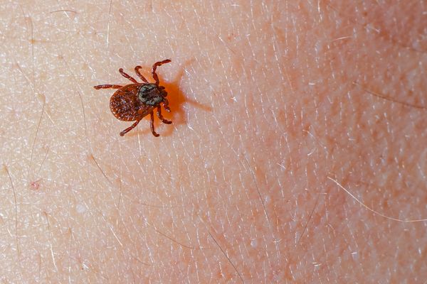 Le diagnostic de la maladie de Lyme, transmise par des tiques, est souvent difficile.