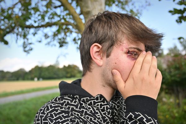 Paul, 17ans été roué de coups sous des insultes liées à son orientation sexuelle le 21 septembre à Mazamet. 3 de ses agresseurs à de moins de 15 ans, sont jugés. Ils nient le caractère homophobe de leur acte.