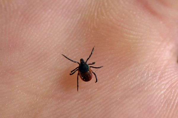 Le CHU de Clermont-Ferrand devient centre de référence pour la prise en charge des maladies vectorielles à tiques, comme la maladie de Lyme.