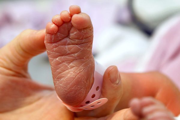 Dans l'Ain, 8 cas suspects de bébés nés sans avant-bras, sans bras ou sans mains, avaient été observés entre 2009 et 2014.