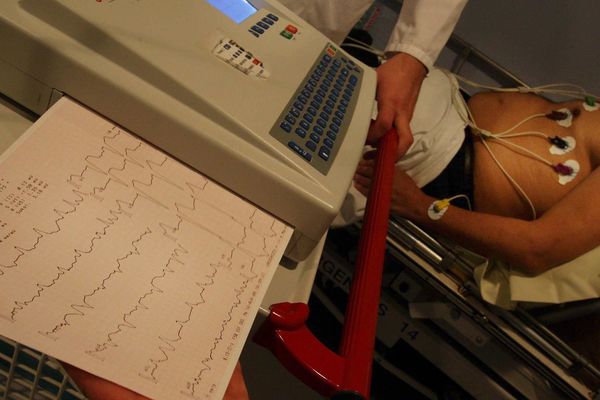 Un électrocardiogramme pratiqué sur un patient.