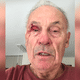 Bernard Dupré, 77 ans, dit avoir été agressé, ce jeudi 4 juillet, alors qu'il collait des affiches d'OIivier Véran sur la commune de La Tronche (Isère).