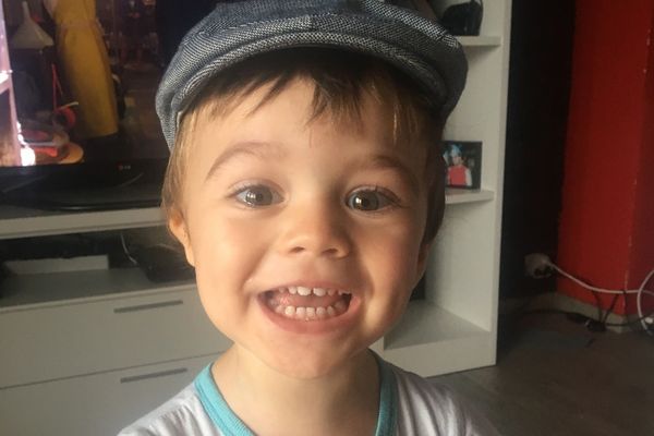 Ruben, 2 ans, est atteint de microtie