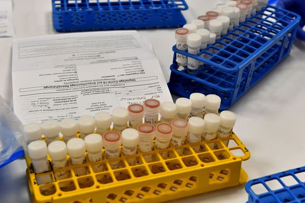 Des tests covid-19 dans un laboratoire de biologie médicale