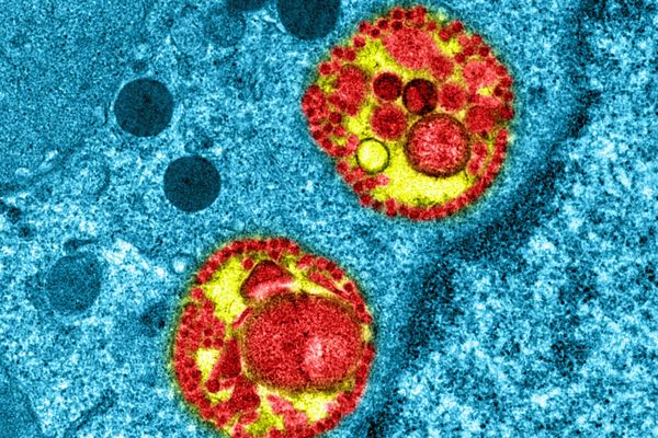 Observation intracellulaire d’un épithélium respiratoire humain reconstitué (en bleu) et infecté par le SARS-CoV-2. On peut noter de larges accumulations de matériel viral, et de virus en assemblage (en rouge).