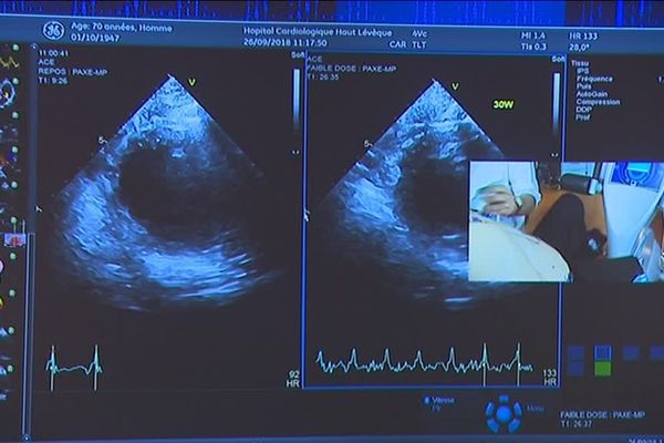 Plus de 1200 cardiologues sont réunis à Bordeaux pour échanger sur leurs pratiques et l'introduction des hautes technologies.