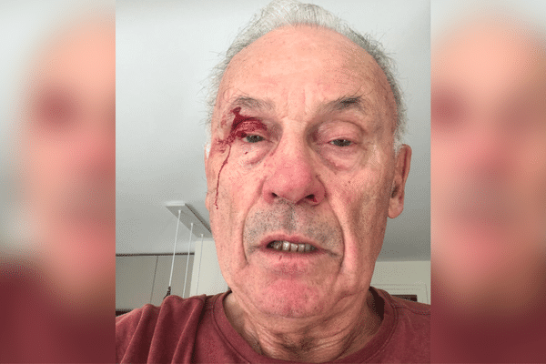 Bernard Dupré, 77 ans, dit avoir été agressé, ce jeudi 4 juillet, alors qu'il collait des affiches d'OIivier Véran sur la commune de La Tronche (Isère).