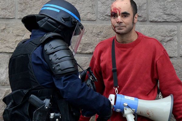 Le procureur de la République a saisi l'IGPN pour déterminer si un homme blessé à la tempe lors de la manifestation contre la loi Travail a été, ou non, victime de violences policières.